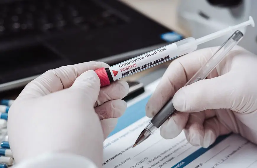Sierologico Test